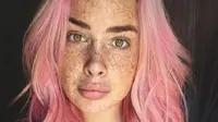 Peyton Smith, gadis cantik berusia 19 tahun ini memiliki banyak freckles kulit tubuhnya. (Foto: Instagram/@speckledgal)