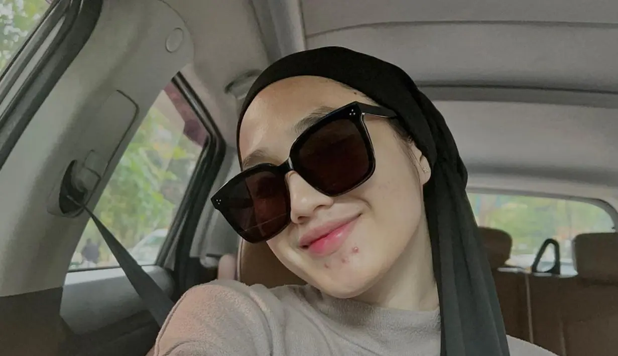 Tak hanya saat hangout atau liburan, Naya juga sering mengenakan kacamata hitam saat momen ‘random’, salah satunya seperti saat di mobil ini. Pakai kacamata hitam yang menutupi setengah pipinya, Hafna Alliya tetap terlihat cantik bahkan meski pamer jerawat di dagu sekalipun. (Liputan6.com/IG/@afnaalliya_)