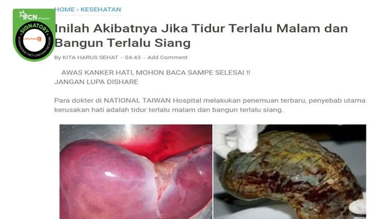 Gambar Tangkapan Layar Kabar Tentang Penyakit Kanker Hati