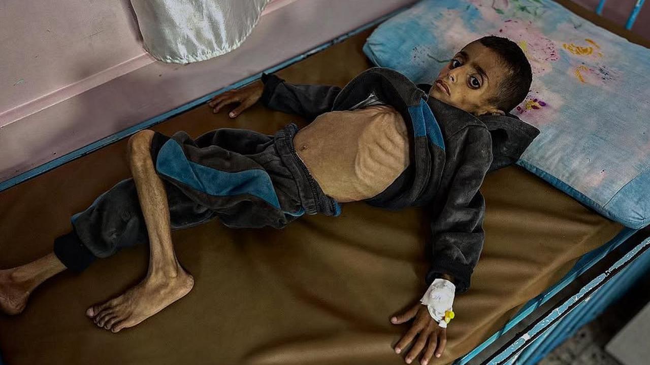 Kita Sedang Membuat Anak-anak Gaza Kelaparan, Kita Semua Bertanggung jawab Atas Situasi Ini
