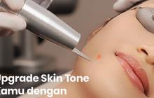 Jenis-Jenis Laser Wajah dan Manfaatnya untuk Kecantikan Kulit