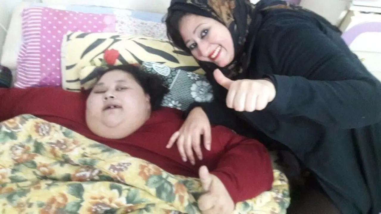 Berbobot 500 Kg, Wanita Terberat Dunia Turun 30 Kg dalam 5 Hari