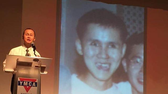 Alami Kecelakaan Tragis, Begini Perjuangan Hidup Pria dengan Otaknya yang Setengah