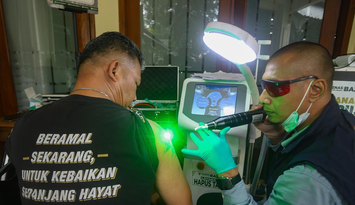 Diselenggarakan di Masjid Sunda Kelapa, Jakarta, tahun 2026, Badan Amil Zakat Nasional (Baznas)/Bazis Provinsi DKI Jakarta menargetkan program ini diikuti sekitar 700 peserta selama bulan Ramadan yang akan berlangsung hingga 3 Maret 2026. Tampak dalam foto, petugas melakukan proses hapus tato pada tubuh peserta di Masjid Sunda Kelapa, Jakarta, Selasa (24/2/2026). (merdeka.com/Arie Basuki)