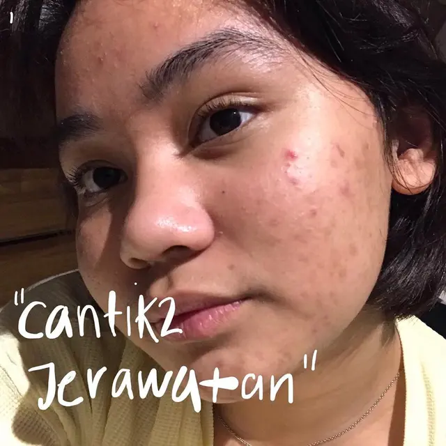 Potret Davina Shafa Tanpa Makeup, Tampil Percaya Diri Dengan Jerawat. (Sumber: Instagram/mimashafa)