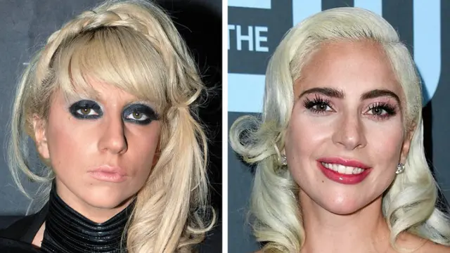 Artis-Artis Hollywood Ini Mukanya Beda Banget dari 10 Tahun Lalu