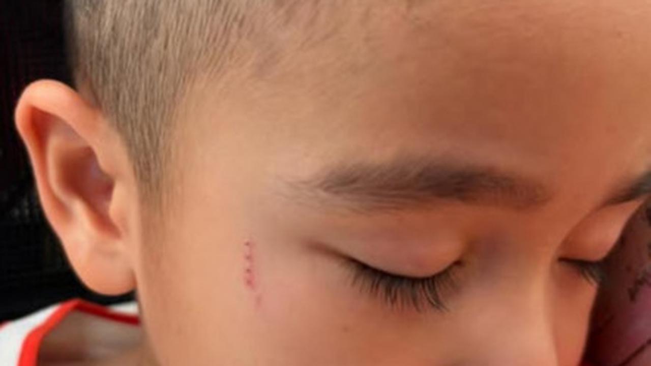 Drama Rayyanza dan Baby Lily yang Berujung Saling Cakar Hingga Gigit, Netizen 'Terpantau Masih 1-1 Skornya Guys'