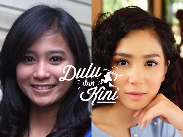 Dulu Dan Kini Transformasi Bunga Zainal Dari Tampil Natural Hingga Mewah Seperti Sosialita Fashion Fimela Com