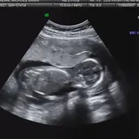 Satu lagi keajaiban yang mungkin gak bisa kamu jelaskan dengan kata-kata. Bayi ini bisa bersujud saat dilantunkan ayat suci Alquran