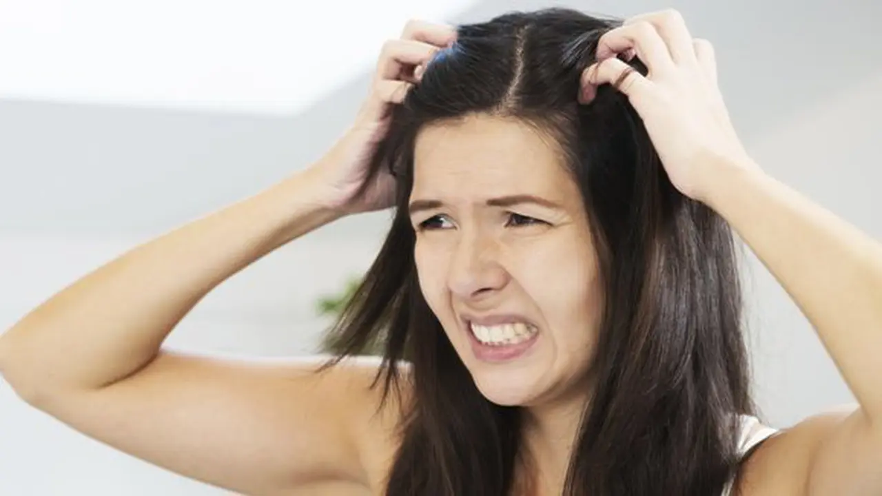 Kulit kepala gatal bakal ganggu aktivitas/copyright: thinkstockphotos.com