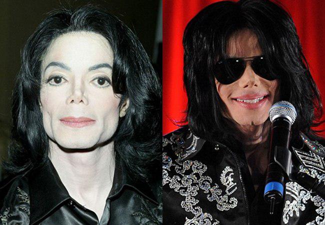 Penampilan Michael Jackson pada tahun 2003 dan 2009. Terlihat Michael memiliki belahan dagu yang terinspirasi oleh dagu Kirk Douglas (kanan) | foto: copyright dailymail.co.uk