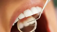Lubang gigi terbentuk ketika bakteri di dalam mulut kita merusak gigi