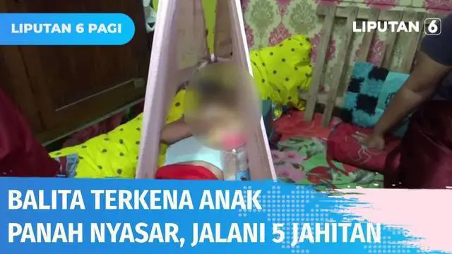 Seorang balita di Makassar terpaksa menjalani lima jahitan setelah terkena anak panah yang dilepaskan orang tak dikenal. Sebelumnya korban tiba-tiba menangis histeris, setelah diperiksa, sang paman terkejut mengetahui ada anak panah menancap di pipi ...