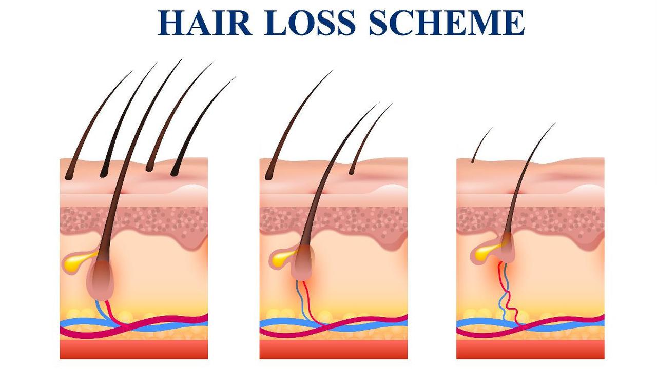 1. Rambut Rontok Tidak Segera Ditangani<br>