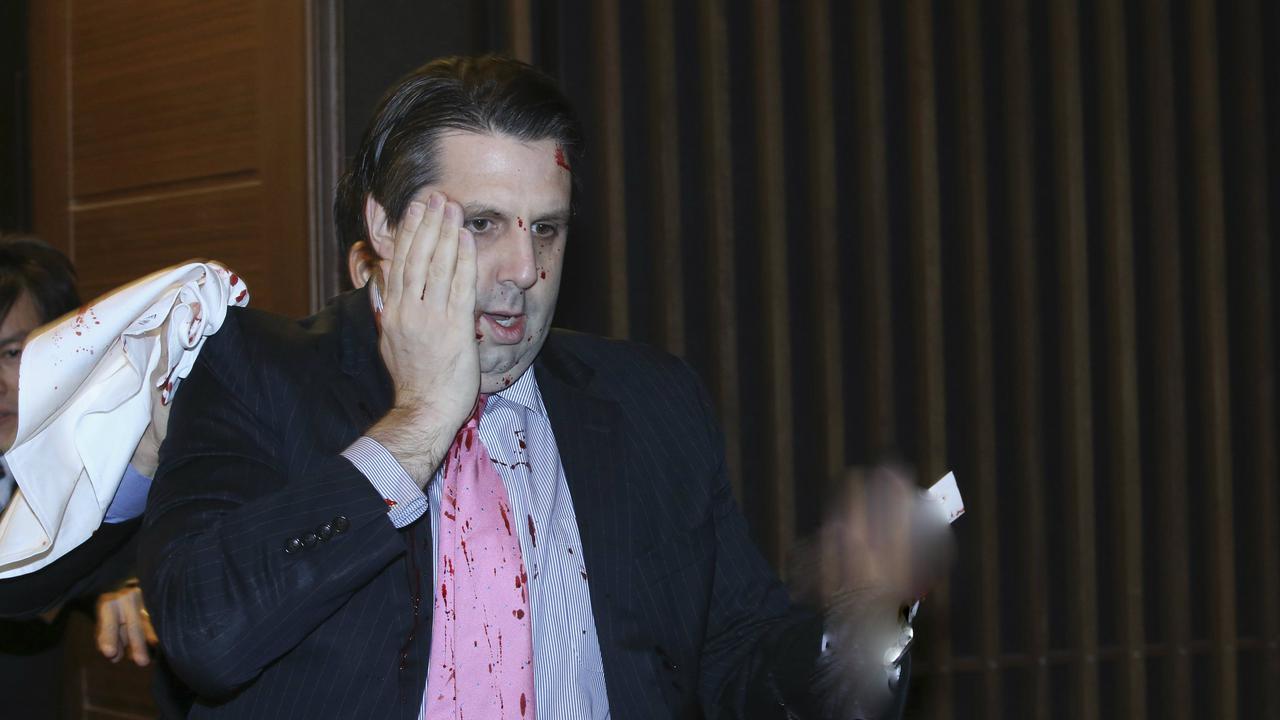 Dubes AS di Seoul Disayat Pisau Pria Misterius