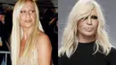 Terlihat jelas Donatella Versace melakukan serangkaian operasi plastik. Coba deh kamu nggak sengaja ketemu dia di jalan yang gelap. Hmmmm... (FoxNews)