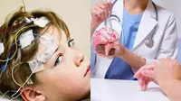 Bocah Ini Orang Pertama di Dunia Implan Otak Obati Epilepsi (Sumber: Ilustrasi dari Unilad