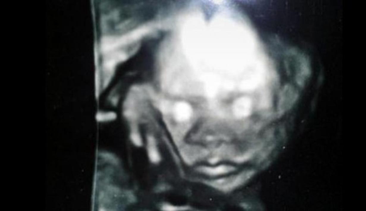 99 Gambar Foto Bayi Hantu Terbaik