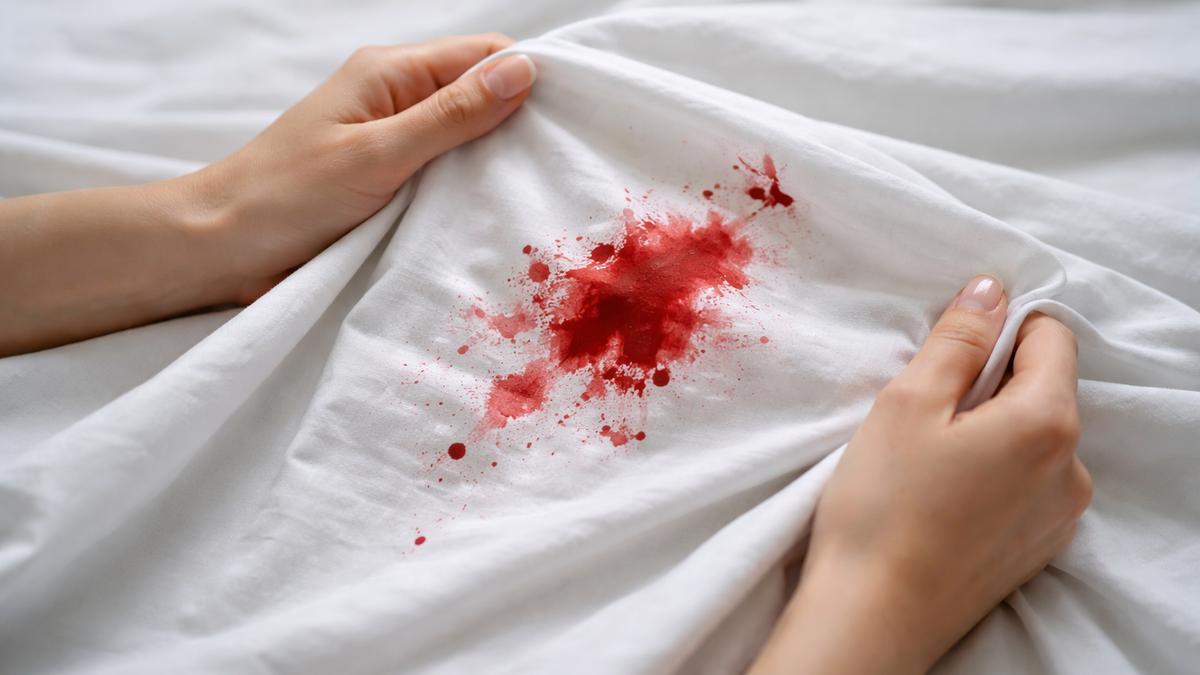 7 Cara Menghilangkan Noda Darah di Sprei Tanpa Dicuci yang Aman untuk Semua Bahan