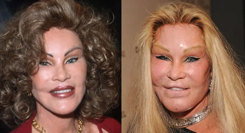 Jocelyn Wildenstein (sumber: womansday.com)