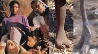 Fakta Suku Vadoma di Zimbabwe Punya Kaki Mirip Burung Unta (Sumber: YouTube/Russ Epp-Leppel)