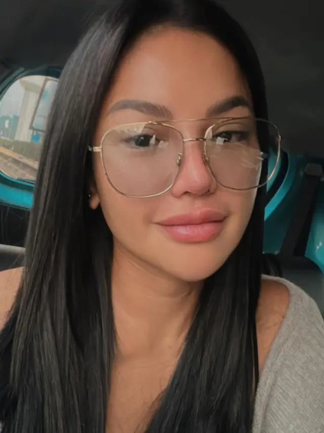 Wajah Nikita Mirzani Pasca Oplas
