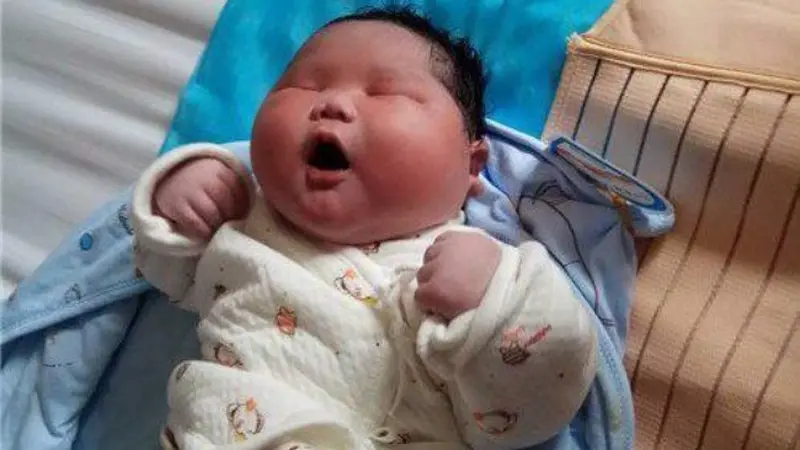 Menakjubkan, Ibu Obesitas Lahirkan Bayi Raksasa Seberat 7 Kg