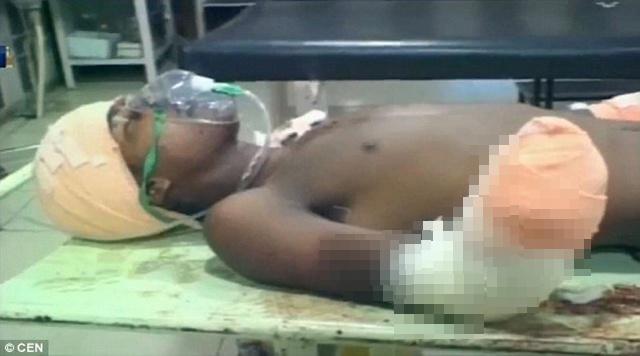 Remaja kehilangan tangannya karena dituduh memperkosa bayi berusia 7 bulan | Photo: Copyright dailymail.co.uk