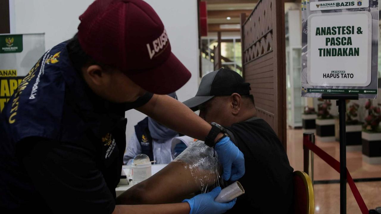 Layanan Hapus Tato Gratis di Jakarta
