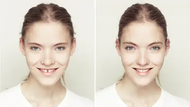 Ini Yang Terlihat Kalau Punya Wajah Simetris Masih Cantik Fimela Fimela Com