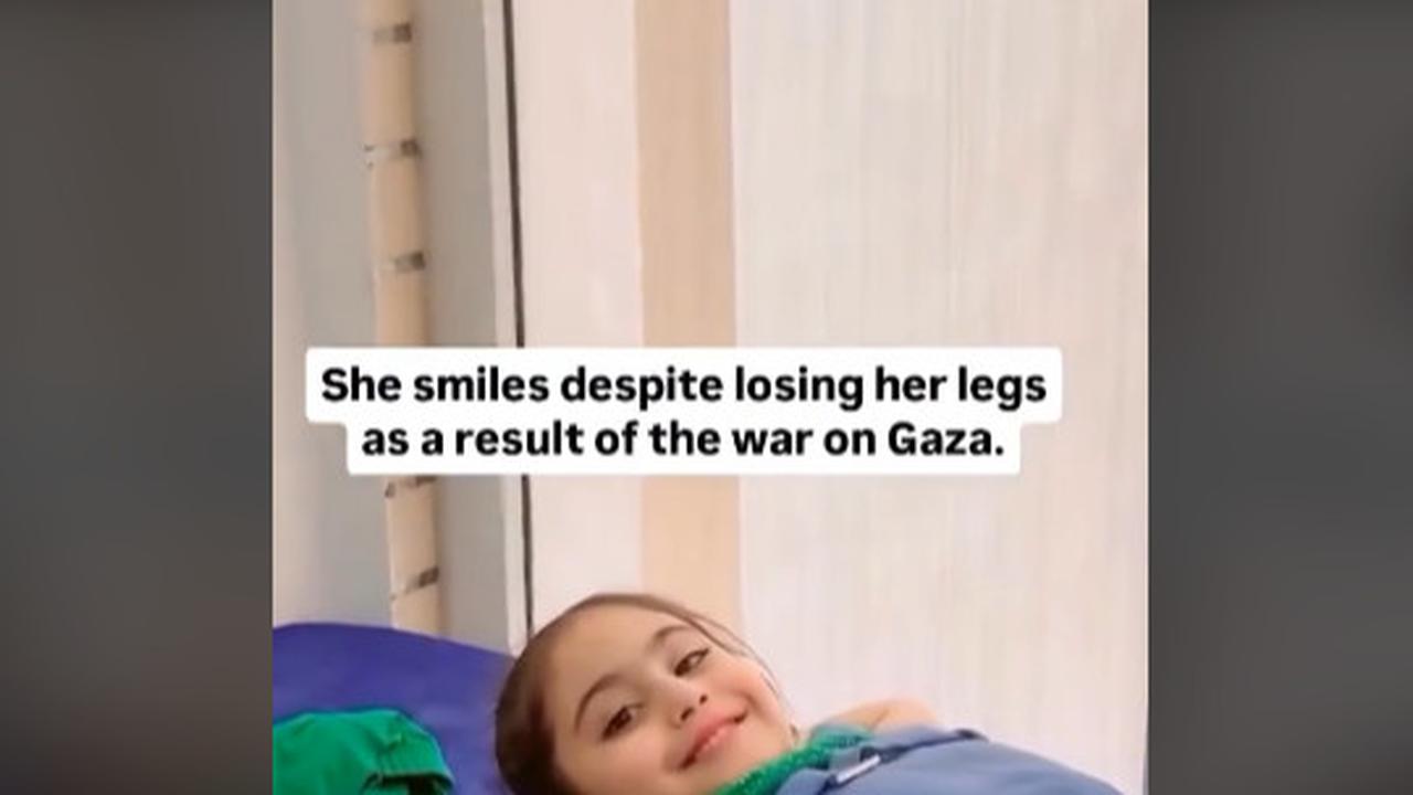 Sosok Luar Biasa Bocah Perempuan Palestina Masih Bisa Tersenyum Walau Kedua Kakinya Hilang Akibat Bom Israel