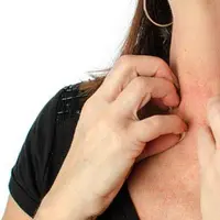 Apa Beda Kulit Berjamur dan Kulit Alergi? 