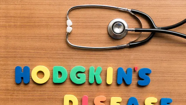 Limfoma Hodgkin atau Hodgkin's disease (iStockphoto)