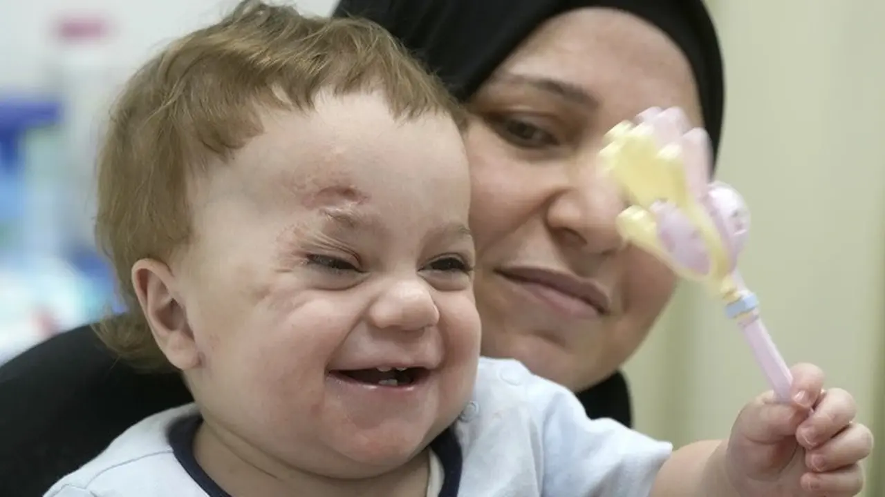 Mostafa Qadoura dari Jalur Gaza bersama neneknya Amna Abd Rabou saat berada di RS Ibu Kota Administratif Baru, di luar Kairo, Mesir, pada 14 Agustus 2024.