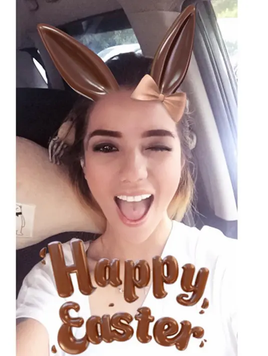 Erie menceritakan bahwa kondisi Sheila sadar, namun mengalami retak tulang hidung dan memar pada bagian wajahnya. Hingga ini ia masih menjalani perawatan intensif di rumah sakit. (Instagram/itsheilamj)