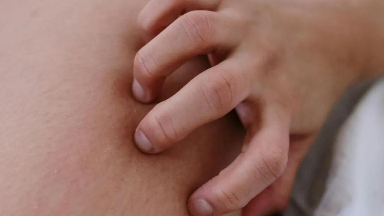 Begini Cara Meredakan Rasa Gatal di Kulit Tanpa Perlu Digaruk