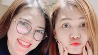7 Potret Mella Rossa, Adik Via Vallen yang Parasnya Mirip Banget