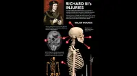 Cedera pada Kerangka Raja Inggris Richard III (LiveScience)