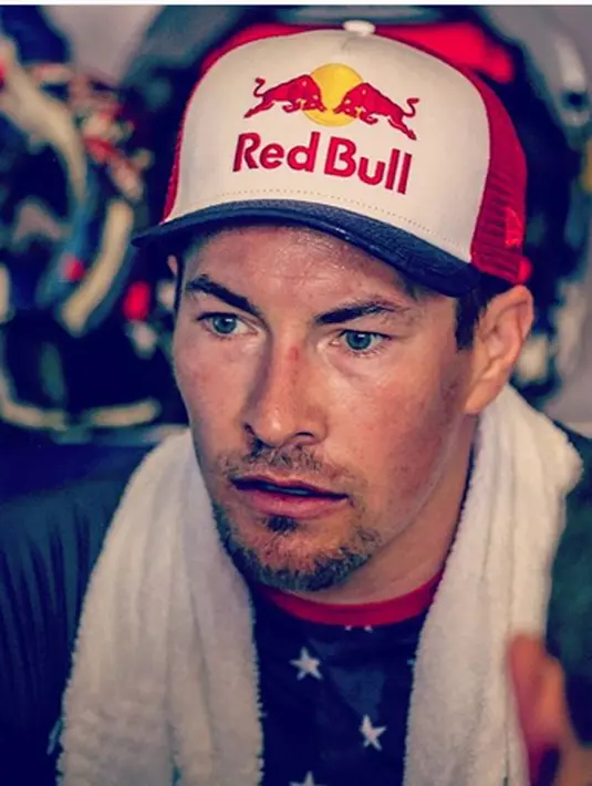 Rabu (17/5/2017) waktu setempat, Hayden sedang berlatih sepeda di kawasan Riccione-Tavoleto, Italia, tiba-tiba ditabarng sebuah mobil sedan dan Hayden langsung terpental membentur kaca mobil bagian depan. (Instagram/nicky_hayden)