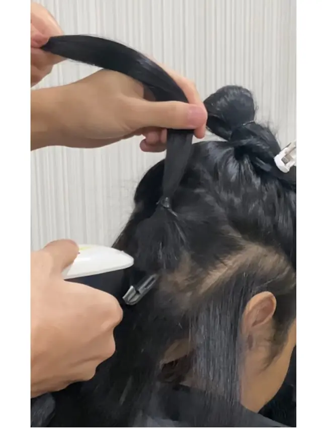 6 Potret Lucinta Luna Transplantasi Rambut di Thailand, Sempat Curhat saat Dibotaki