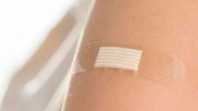 Mengatasi bekas luka