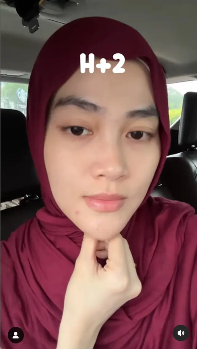 6 Potret tranformasi wajah Henny Rahman istri Alvin Faiz usai perawatan, berubah glowing dan mulus