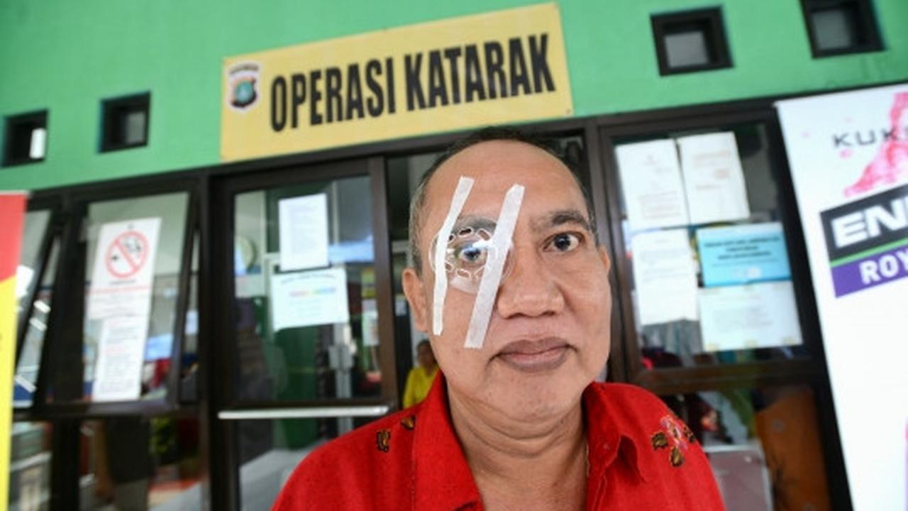 Polda Metro gelar operasi katarak gratis di posko kebakaran Tambora