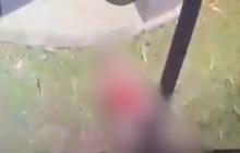 Kondisi Terkini Bocah yang Alami Koma Usai Kesetrum Akibat Dibully