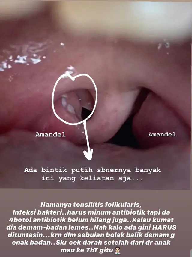 Unggahan Zaskia Adya Mecca. (Foto: Instagram @zaskiaadyamecca)