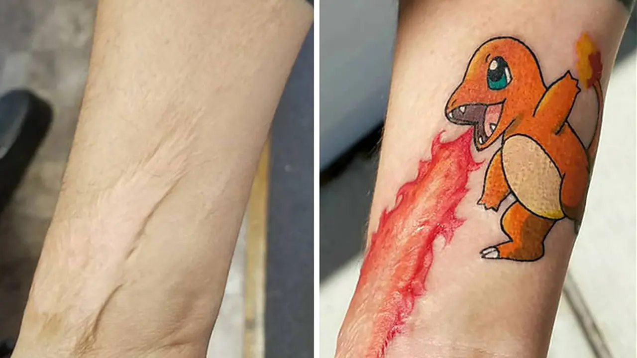 tato dari bekas luka (foto: boredpanda)