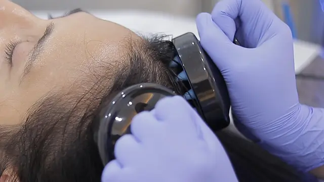 Ilustrasi Klinik Kecantikan untuk Cegah Rambut Rontok