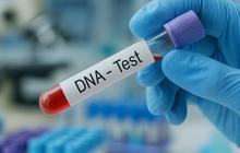 Berapa Harga Tes DNA? Cek Biaya dan Prosesnya