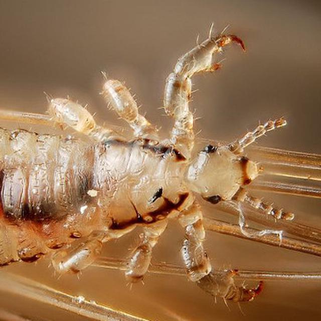 Hati Hati Kutu Hewan Bisa Sebabkan 5 Jenis Penyakit Serius Health Liputan6 Com