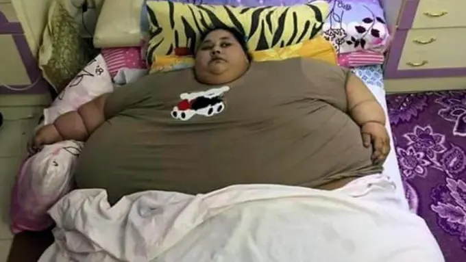 Perempuan Tergemuk Sedunia, Berat Badan Eman 500 Kg